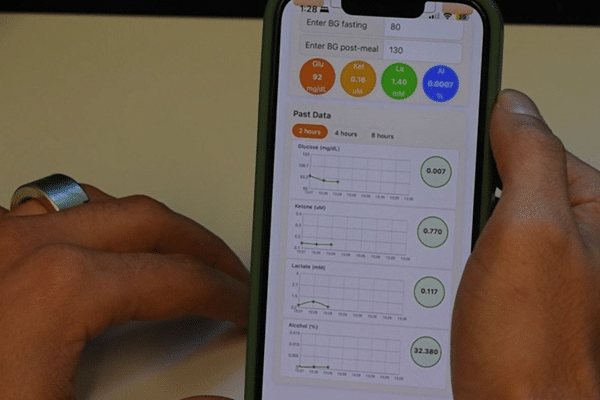 Close-up of a smartphone in two hands showing a health app with past data charts for glucose, ketone, lactate, and alcohol, plus circular color indicators at the top