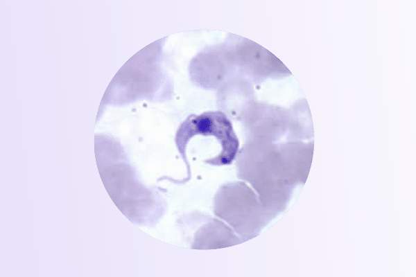 Microscopic image of a curved, purple parasite seen among blood cells in a circular frame.