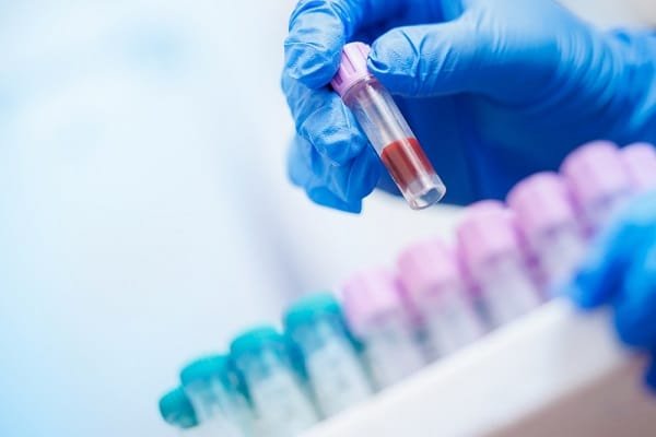 Gloved hand holds a small blood sample vial above a rack of colored test tubes in a lab setting — focus on the sample.