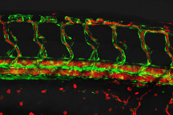 Fluorescent micrograph of a tissue section showing green filamentous networks above a red-stained region against a dark background.
