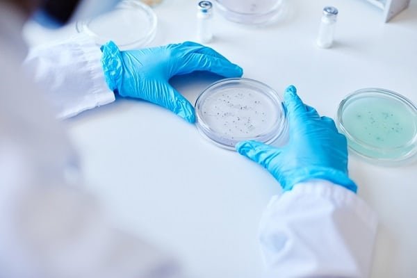 Scientist wearing blue gloves handling a Petri dish with bacterial colonies on a white lab bench.