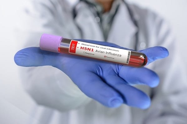 Gloved hand holding a blood test tube labeled 'H5N1 Avian Influenza', purple cap, in a clinical setting.