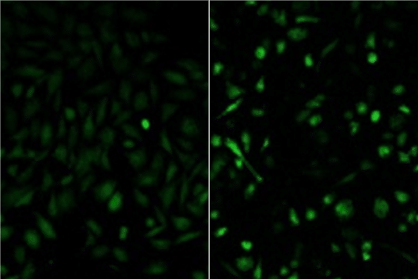 Two-panel fluorescence microscopy image showing green signal in cells; left panel faint green staining, right panel brighter with more prominent green puncta and nuclei.