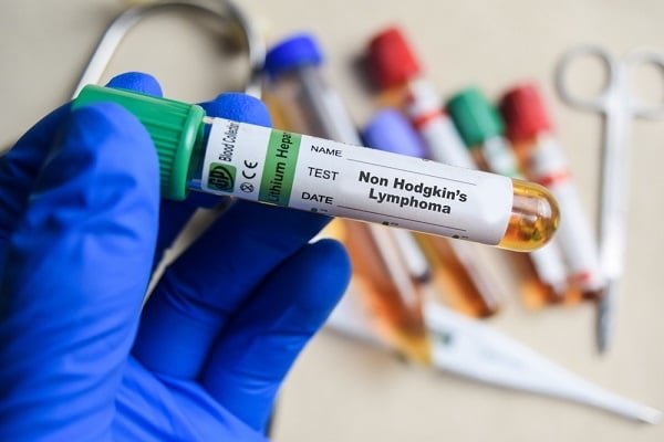 Gloved hand holding a blood sample tube labeled 'Non-Hodgkin's Lymphoma'; blurred background shows additional vials and lab tools.