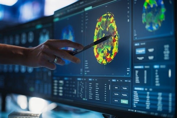 Scientist points at a color-coded brain scan on a computer monitor with multiple diagnostic images.